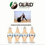 Inner Strength Bayside will be running a round of the GLAD program in April this year. Our Education session 1 will be on Friday 12th of April at 1:30pm covering topics including - Osteoarthritis - Risk factors (modifiable and non modifiable) - Evidence for different treatment options behind Os...